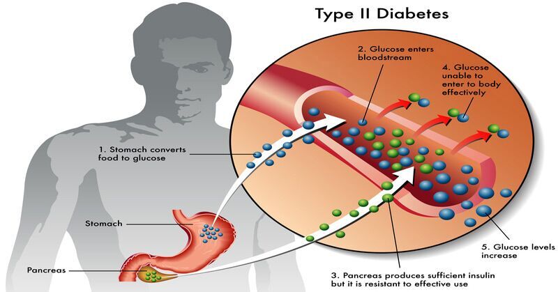Type-2 Diabetes – Reduce Medication with a Healthy Eating Plan